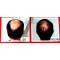 Шампунь от выпадения волос Bio Herbal Anti-Hair Loss 